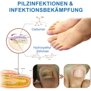 Powerful Light Therapy Device for Treating Nail Disorders - Image 7