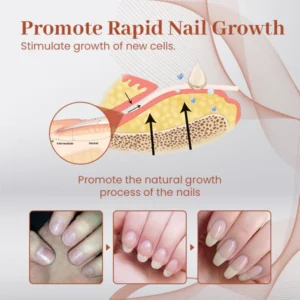 Ultimate Nail Repair Serum - Image 7