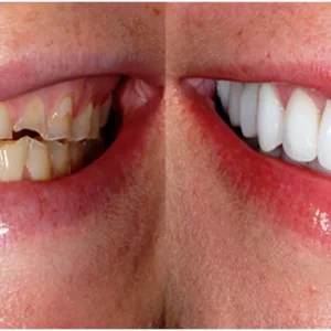 Herbal Brightening Oral Repair Foam - Image 2