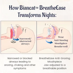 Anti-Snoring Mouthpiece - Image 7