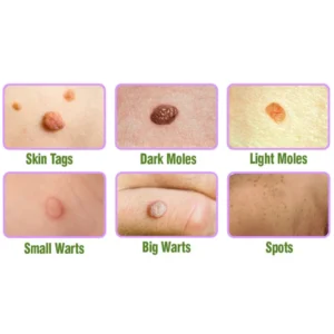 Herbal Treatment Serum - Image 8