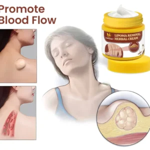 Lipoma Removal Herbal Cream - Image 4