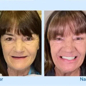 🦷𝐅𝐨𝐫𝐭𝐬𝐜𝐡𝐫𝐢𝐭𝐭𝐥𝐢𝐜𝐡 𝐌𝐚ß𝐠𝐞𝐟𝐞𝐫𝐭𝐢𝐠𝐭 𝐕𝐨𝐥𝐥𝐩𝐫𝐨𝐭𝐡𝐞𝐬𝐞𝐧-𝐒𝐞𝐭 - Image 9