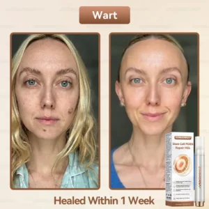 𝐒𝐭𝐞𝐦 𝐂𝐞𝐥𝐥 𝐏𝐃𝐑𝐍 𝐑𝐞𝐩𝐚𝐢𝐫 𝐌𝐢𝐥𝐤