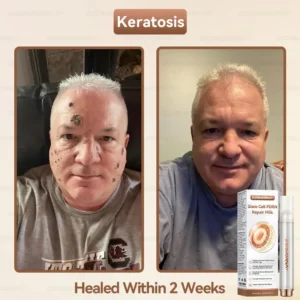 𝐒𝐭𝐞𝐦 𝐂𝐞𝐥𝐥 𝐏𝐃𝐑𝐍 𝐑𝐞𝐩𝐚𝐢𝐫 𝐌𝐢𝐥𝐤 - Image 4