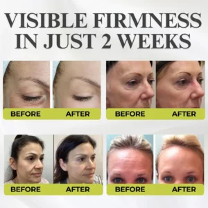Botox & Vita-A Retinol Shot Wrinkle - Lift Tightening Cream - Image 4