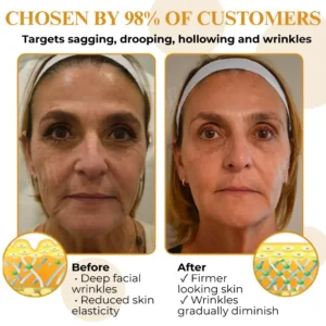 Letybo Bee Venom Wrinkle Removal Cream - Image 4