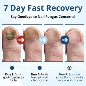 Fungal Nail Patches - Image 5