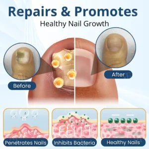 Fungal Nail Patches - Image 6