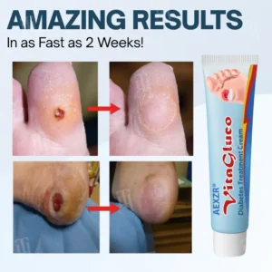 VitaGluco Diabetes Treatment Cream - Image 4