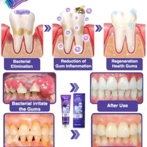 Bee Venom Dental Treatment Toothpaste - Image 7