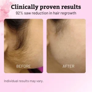Beauty Rotundus Oil for Natural Permanent Hair Reduction - Image 5