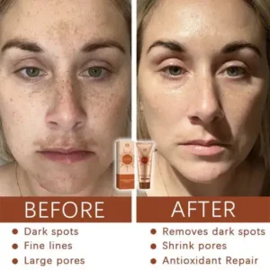 Herbal Spots Peel-Off Facial Mask - Image 5