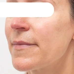 Herbal Spots Peel-Off Facial Mask - Image 7