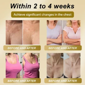 🌞 ROYAL JELLY FIRMING & LIFT PATCH - Image 4