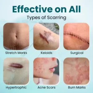 Advanced Scar Gel - Image 6