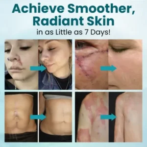 Advanced Scar Gel - Image 7