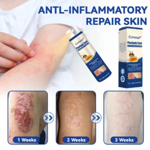 Psoriasis Cure Bee Venom Treatment Spray - Image 5