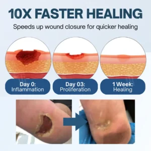 Ulcer-Relief Diabetes Treatment Cream - Image 6