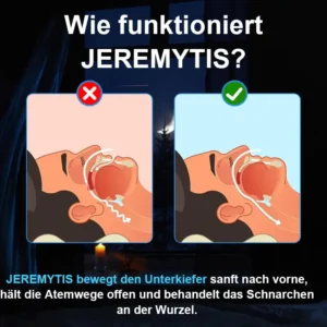 Verstellbares Anti-Schnarch-Mundstück - Image 3