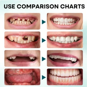Denture Adhesive - Image 8
