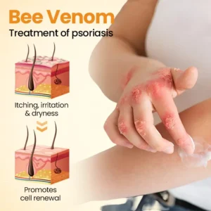 [Official Authorized Store] BeeLieves Psoriasis Skin Care - Image 7