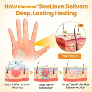 [Official Authorized Store] BeeLieves Psoriasis Skin Care - Image 8