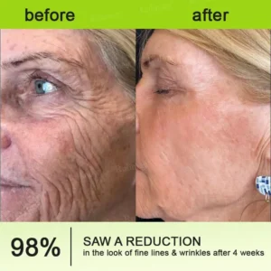 Botox & Vita-A Retinol Shot Wrinkle-Lift Tightening cream - Image 18