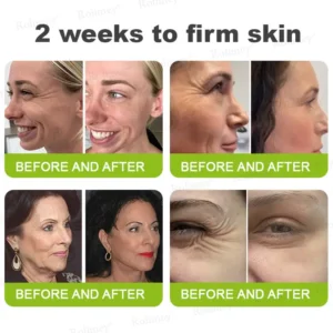 Botox & Vita-A Retinol Shot Wrinkle-Lift Tightening cream - Image 12