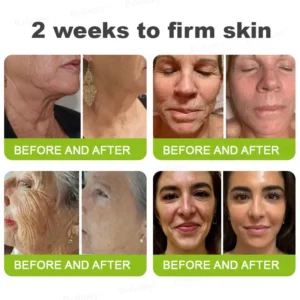 Botox & Vita-A Retinol Shot Wrinkle-Lift Tightening cream - Image 13