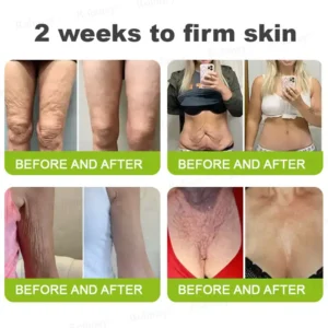 Botox & Vita-A Retinol Shot Wrinkle-Lift Tightening cream - Image 14