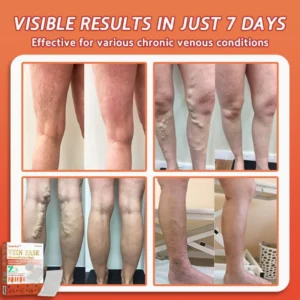 Vein Ease Microneedle Care Patch - Image 2