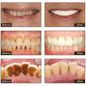Niacinamide Whitening Toothpaste - Image 14