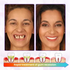 Advanced Gum Regeneration Toothpaste - Image 3