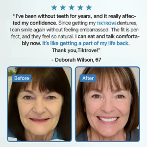 Tiktrove Adsorptive Denture - Image 9