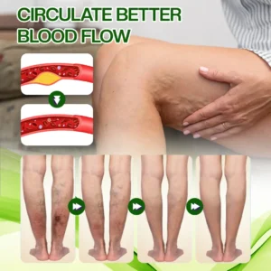 Horse Chestnut Edema Cream - Image 9