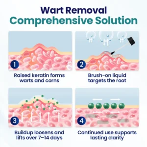 Corn Removal Liquid - Image 8