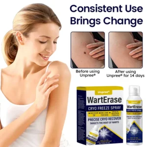 Cryo Freeze Spray
