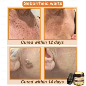 Bee Venom Skin Restoration Cream - Image 6