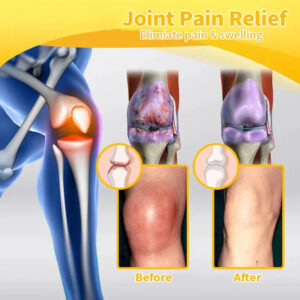 Zentheca BeeThera | Bee Venom-Infused Relief for Bones & Joints - Image 3