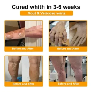 Botulinum Toxin & Bee Venom Pain-Relief Bone Healing Cream - Image 16
