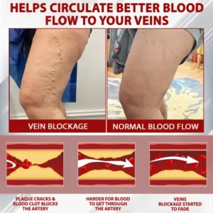 Advanced CVI Edema Therapy Cream - Image 7