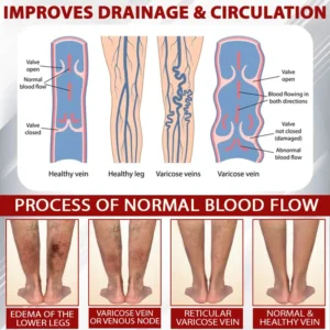 Advanced CVI Edema Therapy Cream - Image 8
