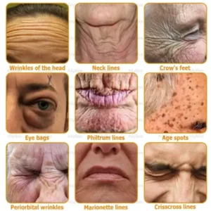Botox Skin Treatment Cream - Image 3