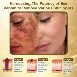 Botox Skin Treatment Cream - Image 4