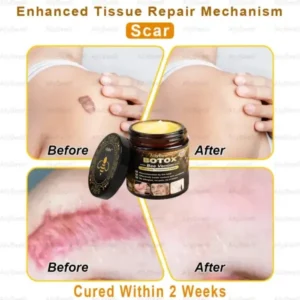Botox Skin Treatment Cream - Image 6