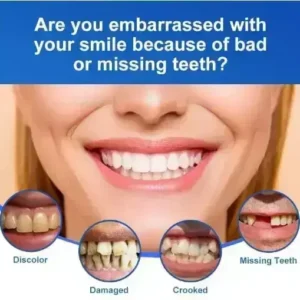 -🦷Advanced Customized Full Denture Set🦷 - Image 4
