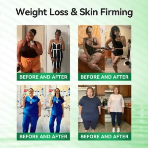 Caffeine · L-Carnitine × Retinol | Slimming & Firming 2-in-1 Nano Microneedle Patch - Image 2