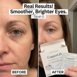 CopperLift Microneedle Eye Patches - Image 3