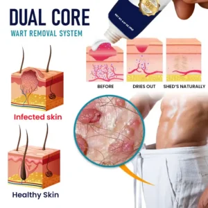 Genital Warts Remover Cream - Image 5
